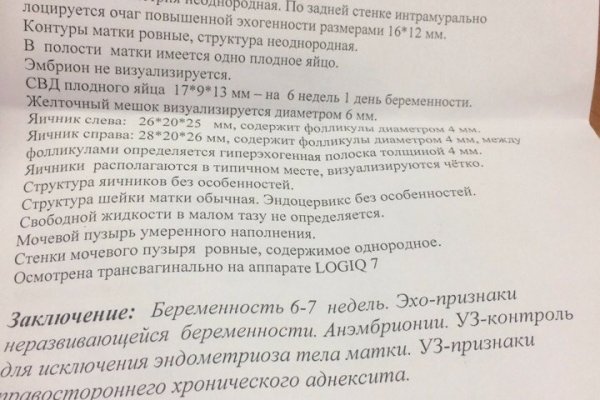Не получается зайти на кракен